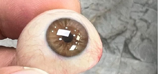 义眼片，医院能定制吗？要不要做手术？